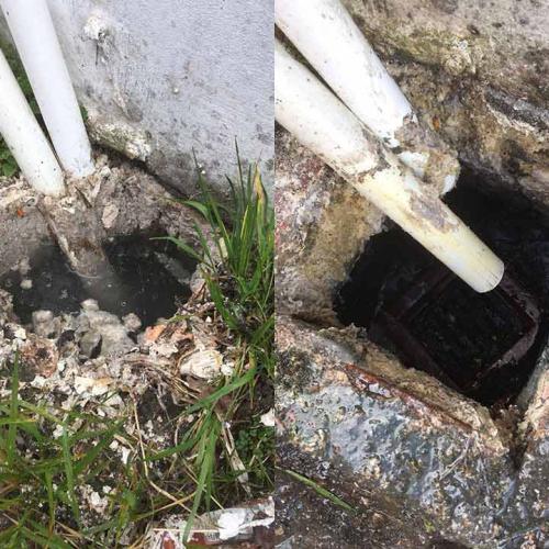 Before and after fat removal